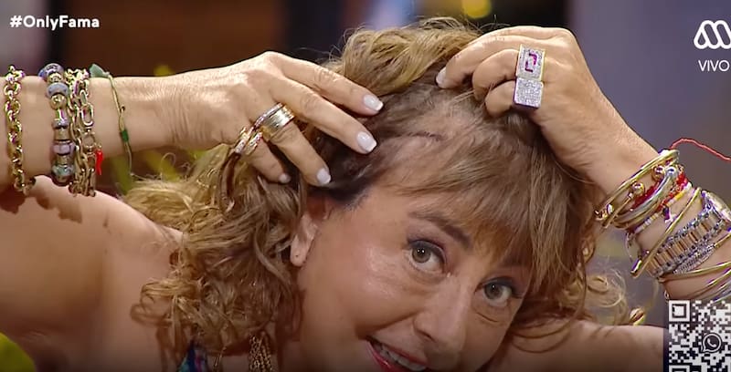 mostró los puntos que tiene en su cabeza.