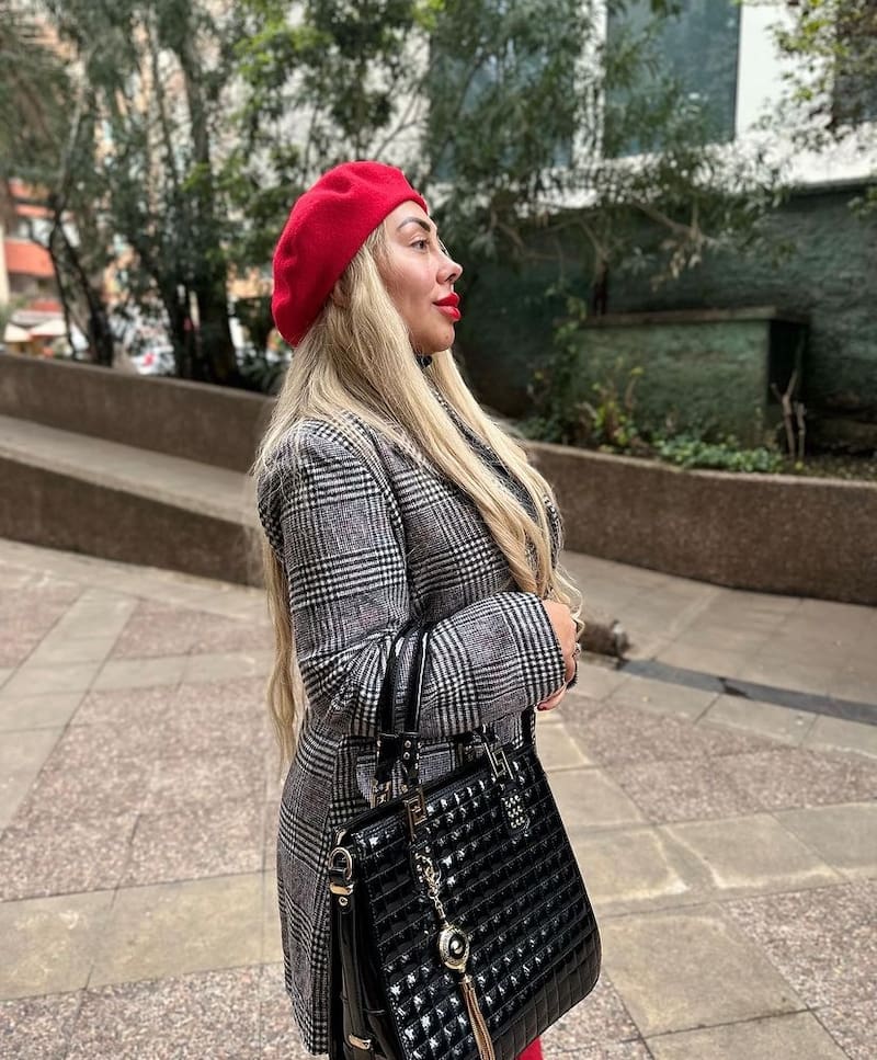 Naya fácil comparte los resultados de su procedimiento estético. Foto: Instagram.