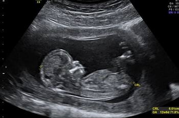 Hijo de Banfield y Lanús: El bebé que es socio en dos clubes rivales de Argentina