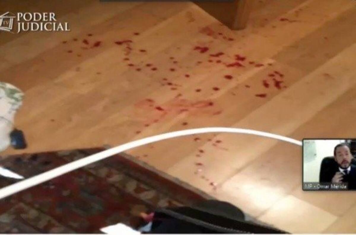 Fotos: Las lesiones provocadas por Nano Calderón a su padre