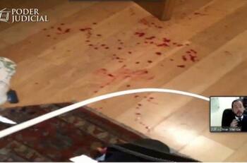 Fotos: Las lesiones provocadas por Nano Calderón a su padre