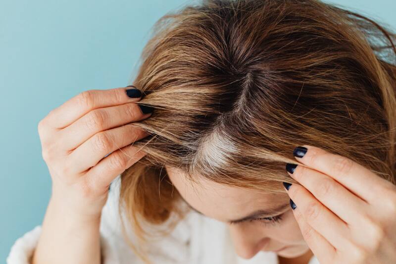 Este remedio casero te ayudará a tener un tono uniforme y poder cubrirlas.