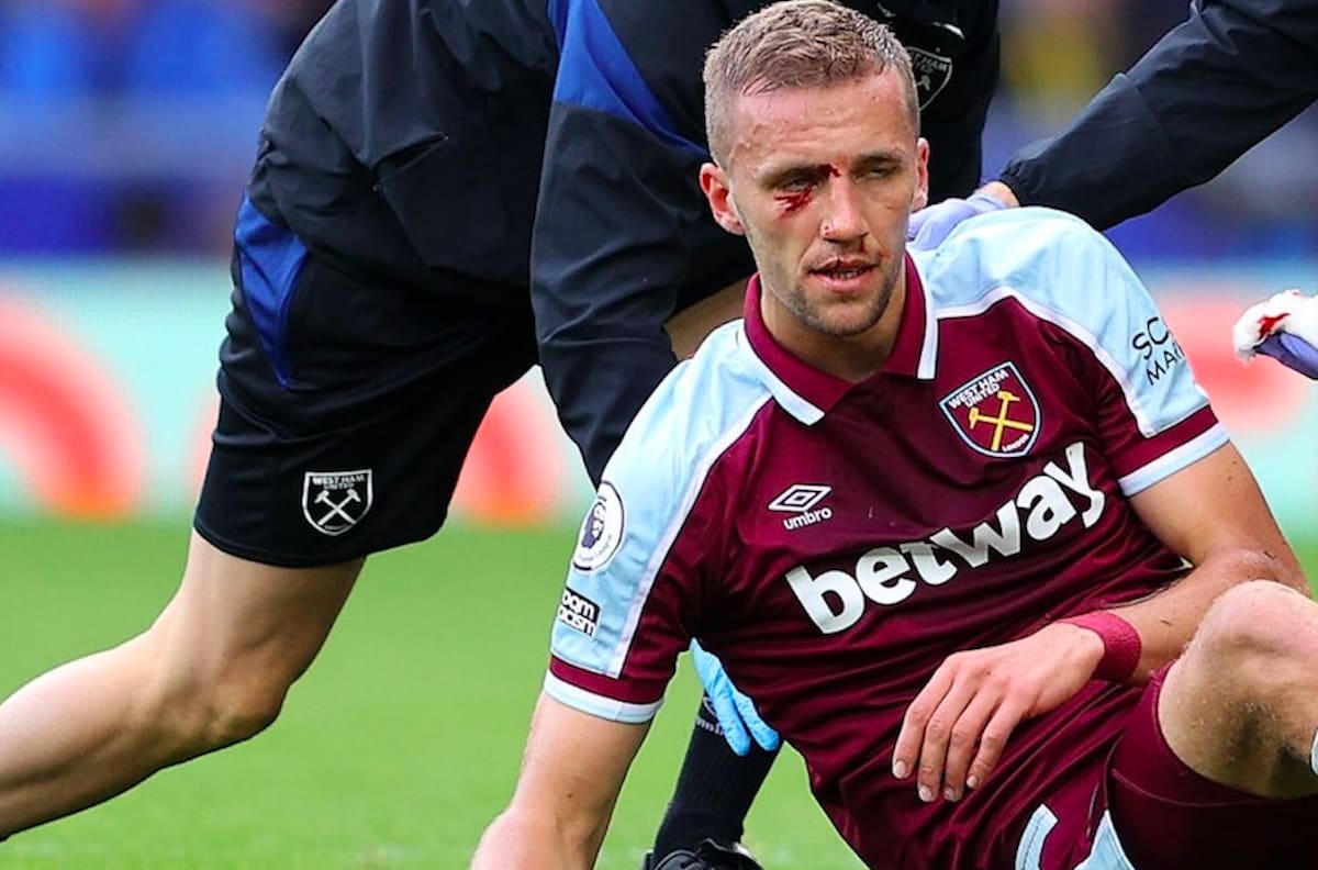 VIDEO | Jugador del West Ham recibió brutal pisotón en la cara que lo dejó con puntos