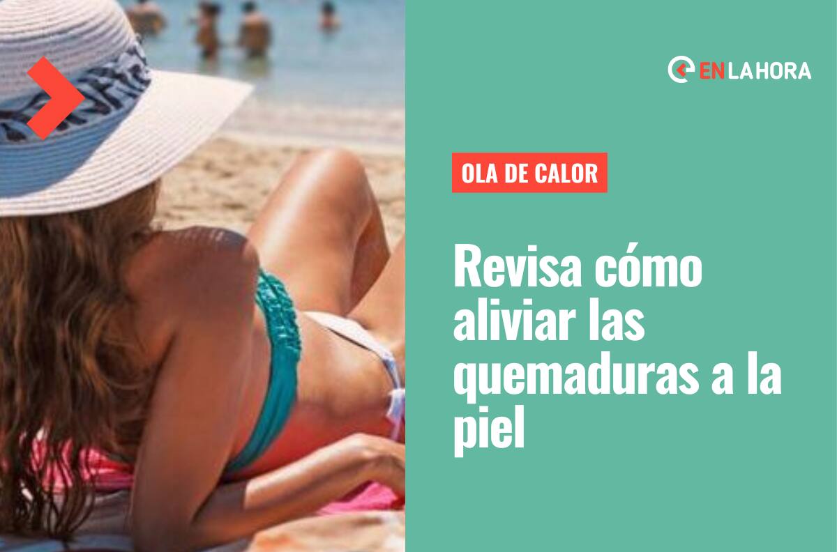 Ola de calor en Santiago: Conoce qué hacer ante una insolación y cómo aliviar las quemaduras de sol