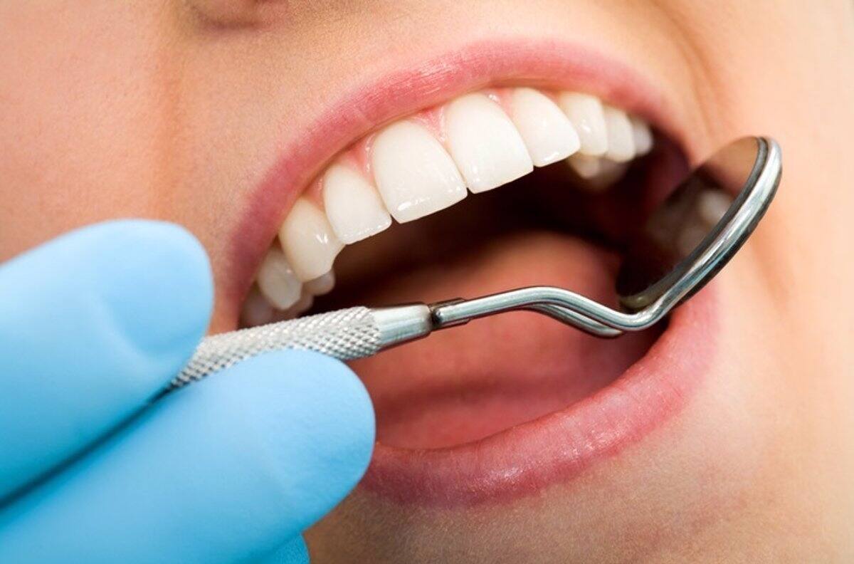 Cinco mitos sobre la higiene bucal y cómo evitarlos para mejorar la salud dental