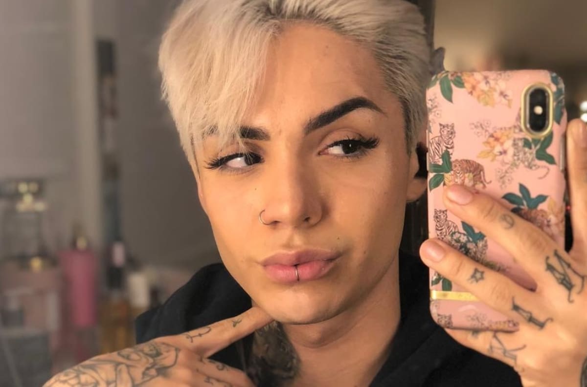 "Falla mi cara, se me cierran puertas de trabajo": Leo Méndez Junior realizó dura denuncia a clínica estética tras sufrir complicaciones por una cirugía