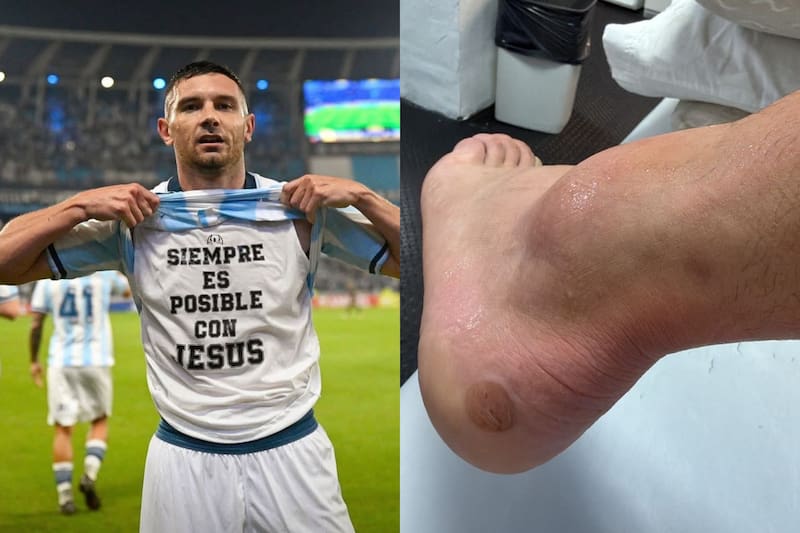El delantero lesionado en Racing.