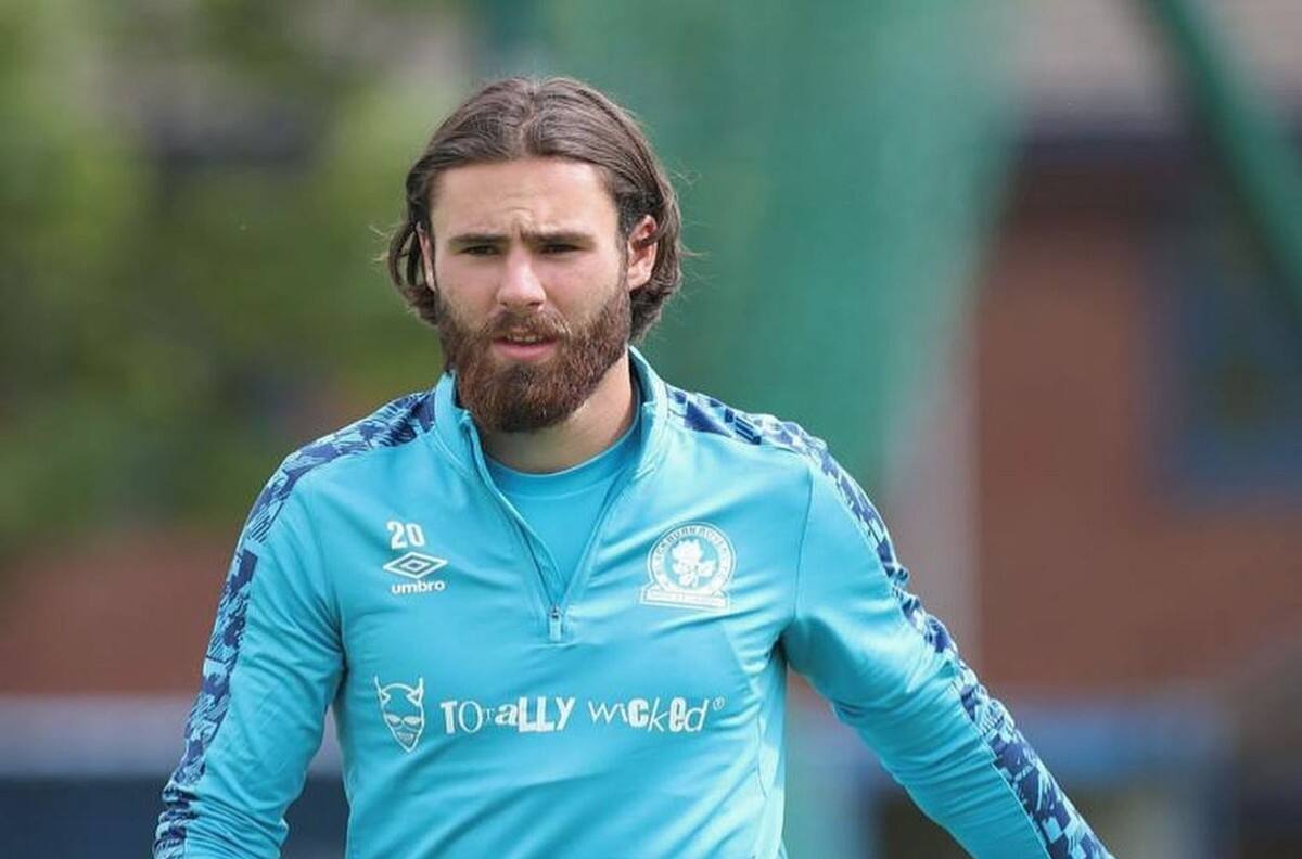 DT de Blackburn Rovers: "Ben Brereton siempre ha tenido talento, no es que se lo hayan inyectado en Sudamérica"
