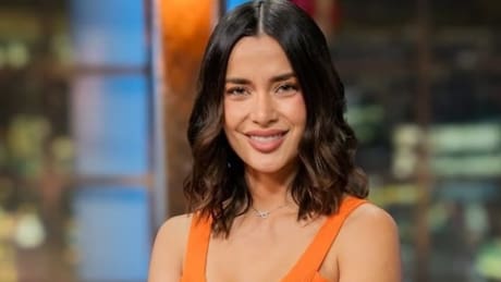 “Me cuesta acostumbrame”: Camila Campos muestra el resultado tras someterse a cambio estético