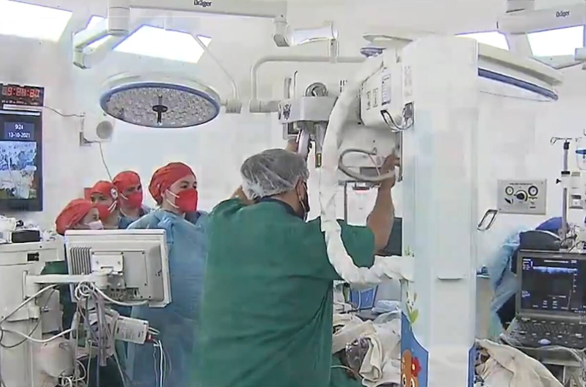 Exitosa cirugía a siamesas: intervención duró 15 horas y participaron 60 especialistas