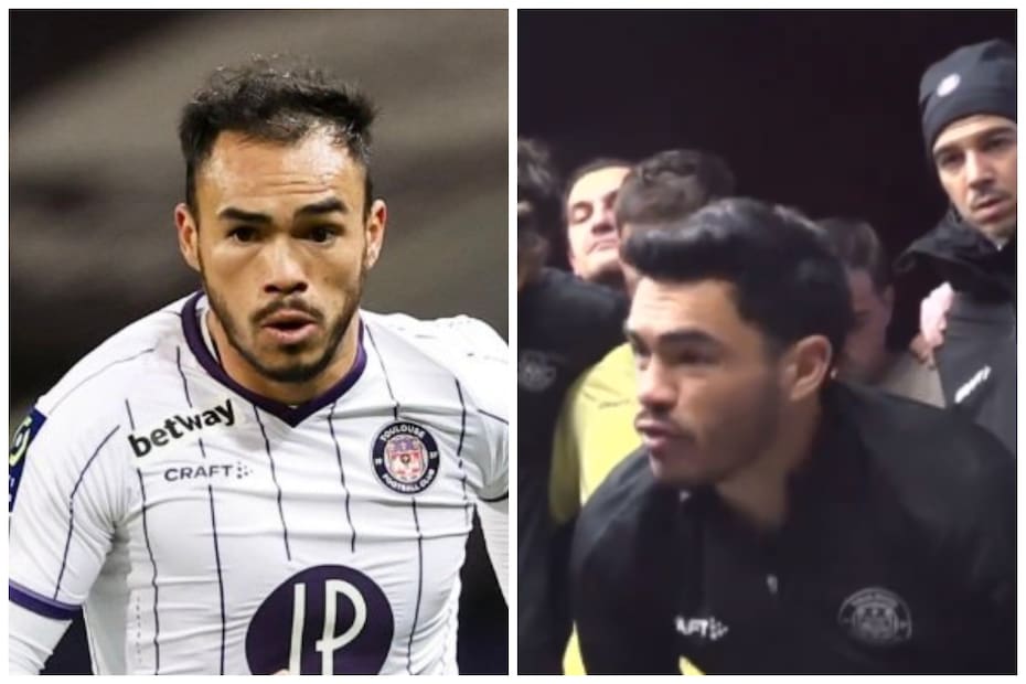 Gabriel Suazo antes y después de realizarse el injerto de pelo.