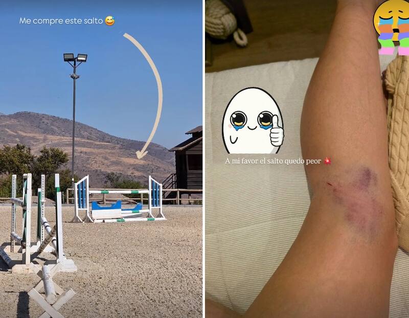 La abogada se lesionó tras caerse del caballo. Créditos: Instagram
