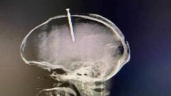 Increíble: Hombre se enterró un clavo en la cabeza porque sentía su cerebro flojo