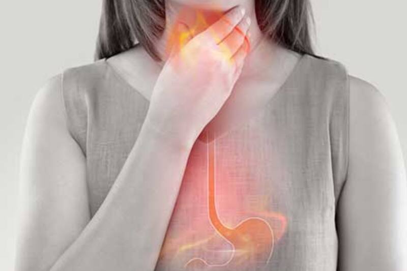 Uno de los alimentos que debes eliminar es el chocolate.