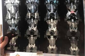 Tiene dos vaginas: Mujer creyó hasta los 16 años que era normal