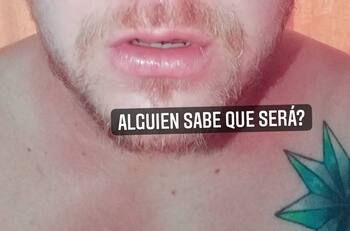 La extraña inflamación que afectó a Ariel Osses, recordado “Elfi” de “Yingo”: “Mi nariz era como una pelota de tenis”