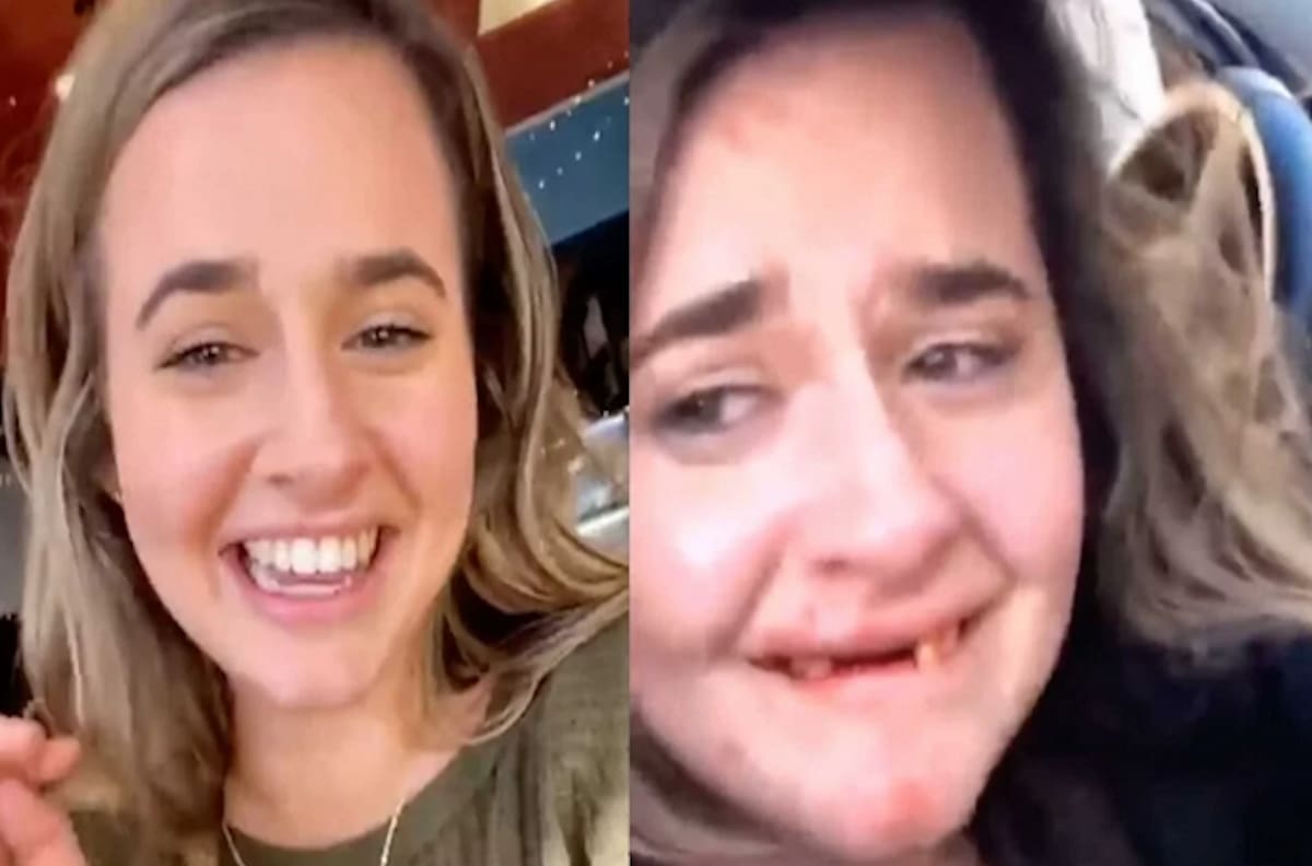 Reto en Tiktok terminó mal: joven perdió sus dientes y tuvo que ser operada