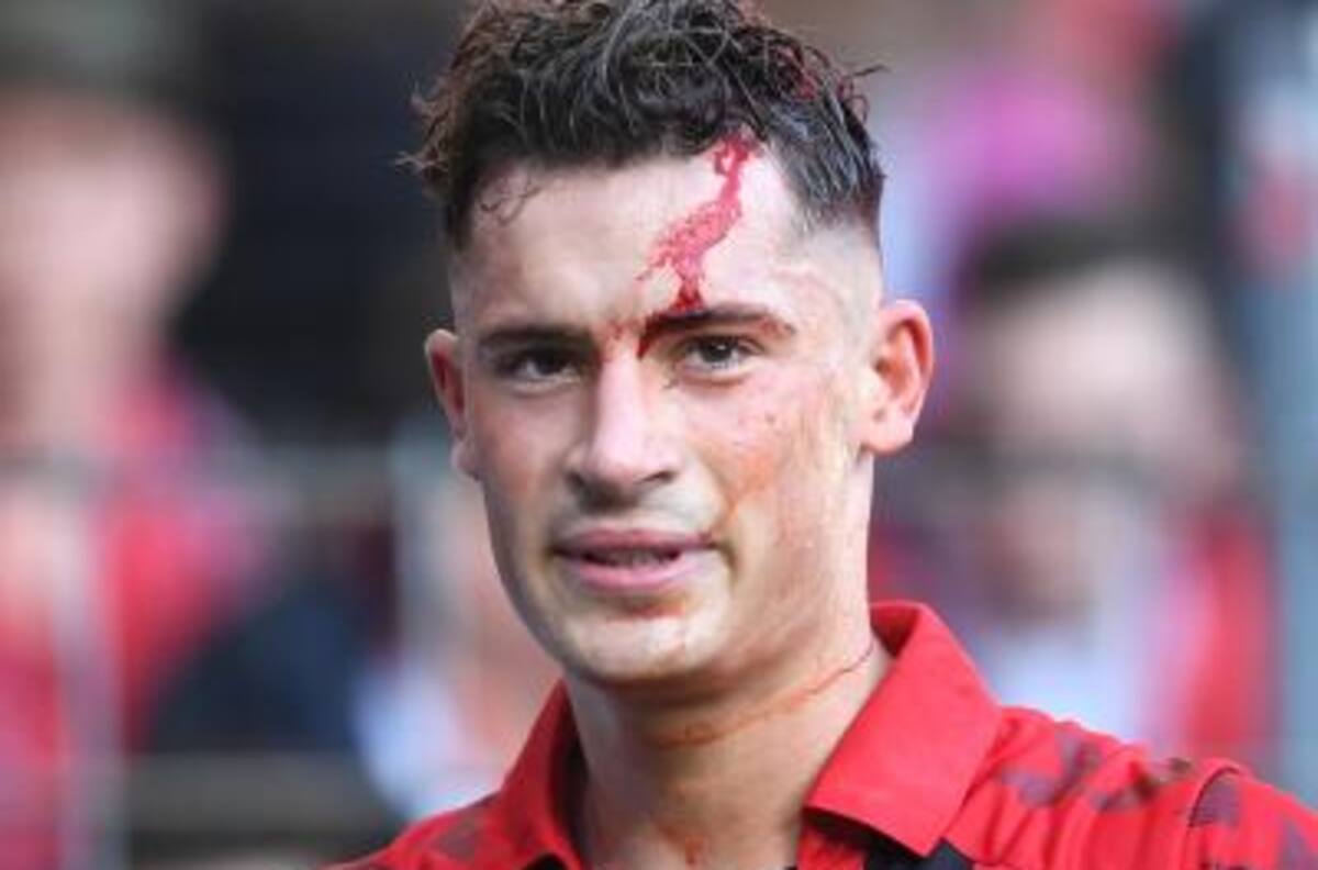 Defensor del Friburgo se dio tremendo golpe con un cartel y salió llenó de sangre