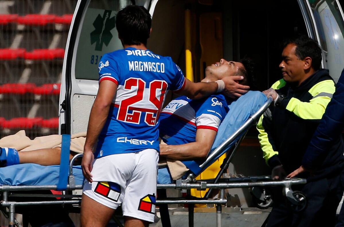 Francisco Silva sufrió una fractura de tibia y peroné