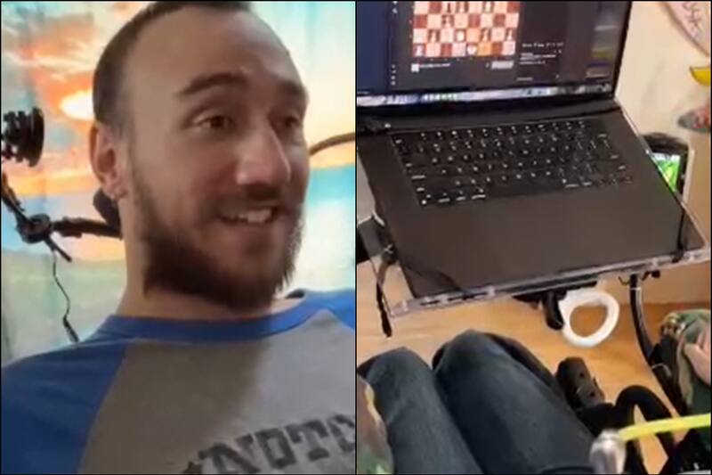 El increíble registro del paciente con chip cerebral.