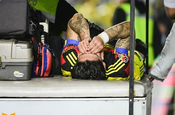 VIDEO | Con gritos de dolor y trasladado a un hospital: futbolista chileno sufre terrible lesión en México