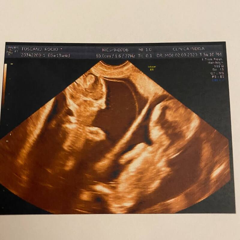 Una de las imagenes que publicó la actriz. Créditos: @rociotoscanoactriz.