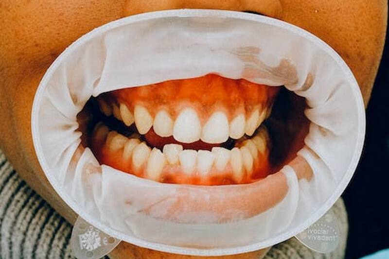 Sigue estos consejos para tener alivio temporal.