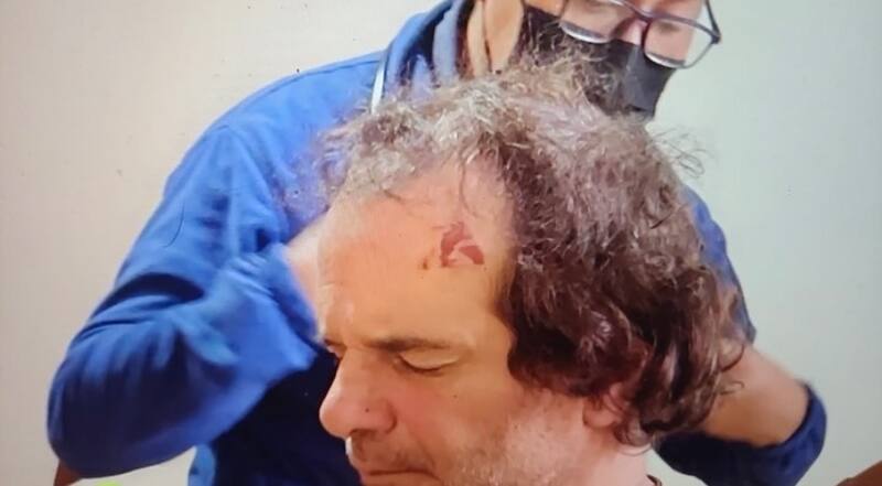 El periodista sufrió múltiples lesiones tras el violento robo, entre ellas en su boca, cabeza y oído.