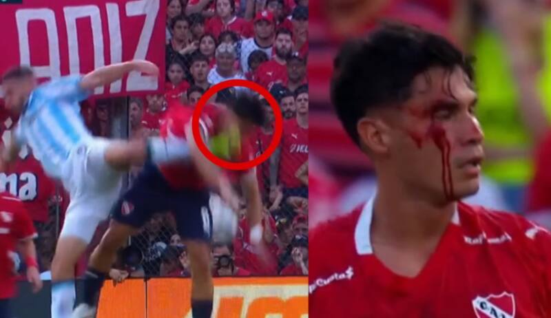 El volante chileno quedó ensangrentado en el final del Clásico de Avellaneda.