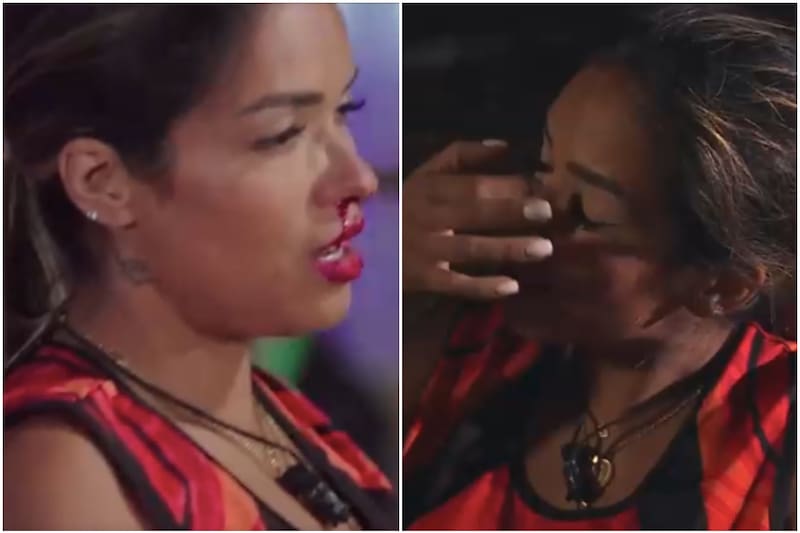 La participante sufrió un agrava accidente que la dejó fuera de competencia.