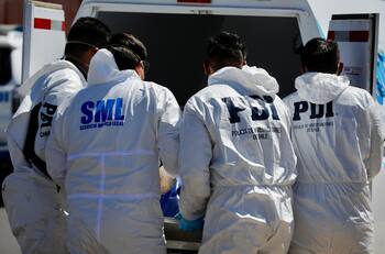 Mujer murió tras someterse a cirugía clandestina de implante mamario en su casa