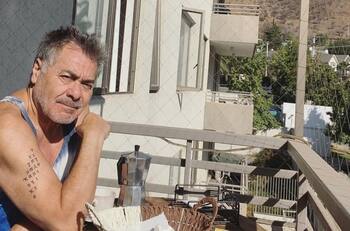 “¿Qué tal el cambio?”: Pato Torres muestra el antes y después luego de realizarse retoque estético en el rostro