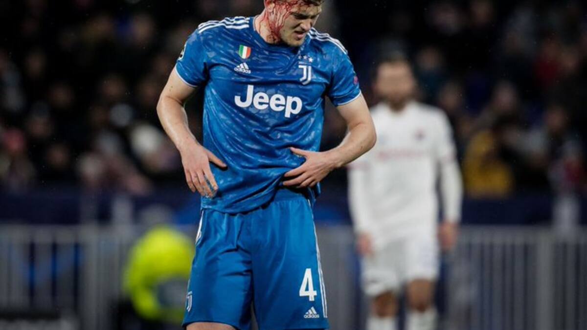 El impactante corte en la cabeza que recibió Matthijs de Ligt en la derrota de Juventus