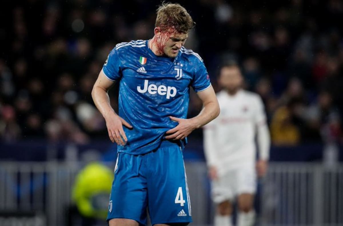 El impactante corte en la cabeza que recibió Matthijs de Ligt en la derrota de Juventus