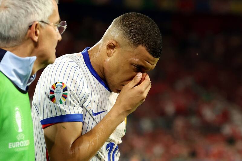 Mbappé encendió las alarmas en Francia tras un choque accidental. (Foto: EFE)