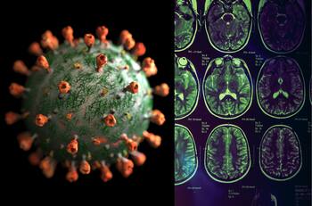 Covid-19 provoca envejecimiento prematuro del cerebro: Rendimiento cognitivo cae en 10 años