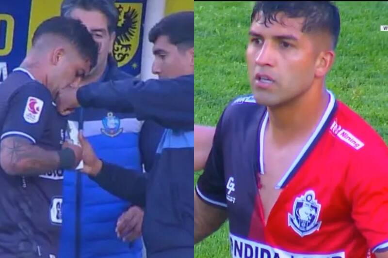 Le tuvieron que corchetear la polera.