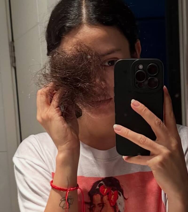 La actriz se sinceró sobre la caída de su pelo. Créditos: Instagram