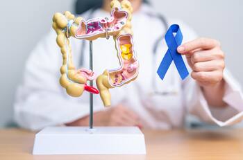 Cáncer de colon: consejos de Harvard sobre exámenes preventivos y personas de riesgo