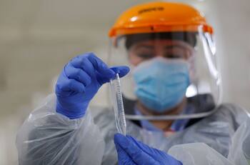 Informe COVID-19: Minsal reportó 4.141 casos nuevos y una positividad de 9,88% este martes