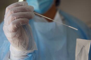 Mujer perdió cartílago de la nariz por un PCR mal hecho en Argentina