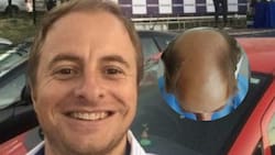 “Remontada épica”: El irreconocible antes y después de Coke Hevia tras implante capilar