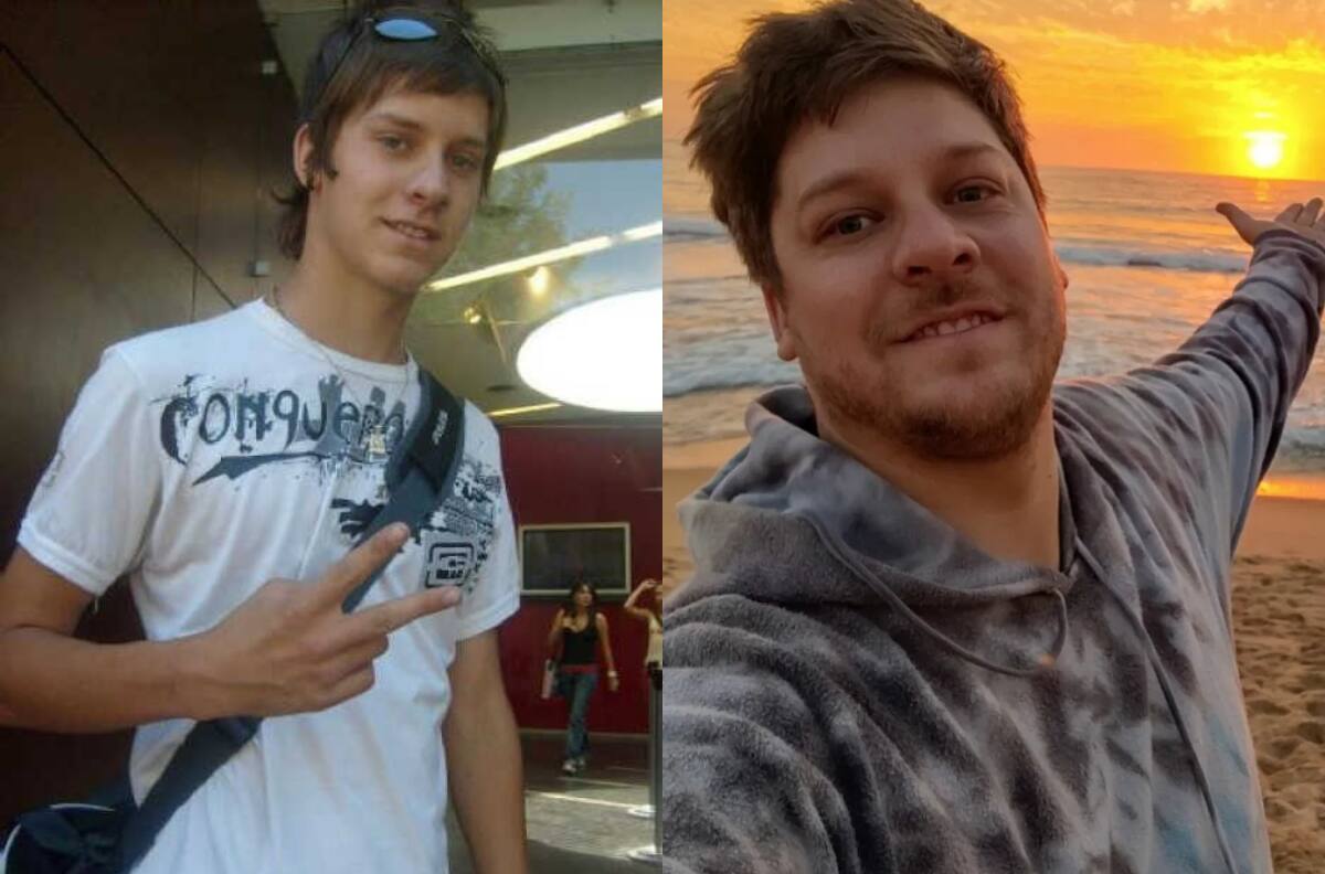 Ariel Osses impactó a sus seguidores con su cambio físico tras someterse a cirugía