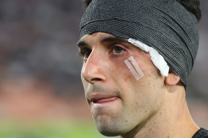 El extremo recibió un duro golpe en la Noche Alba Solidaria. Foto: Aton.