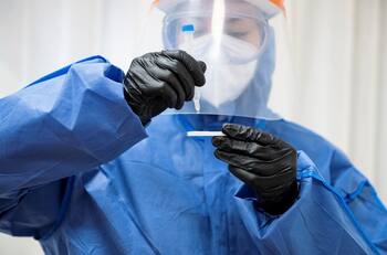 Número de fallecidos por coronavirus alcanza su cifra más baja desde el 18 de noviembre