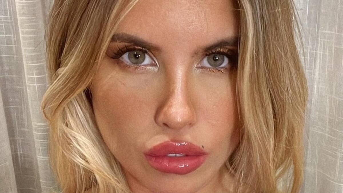 "No saben ná lo que me pasó": El divertido chascarro que vivió Coté López con su outfit
