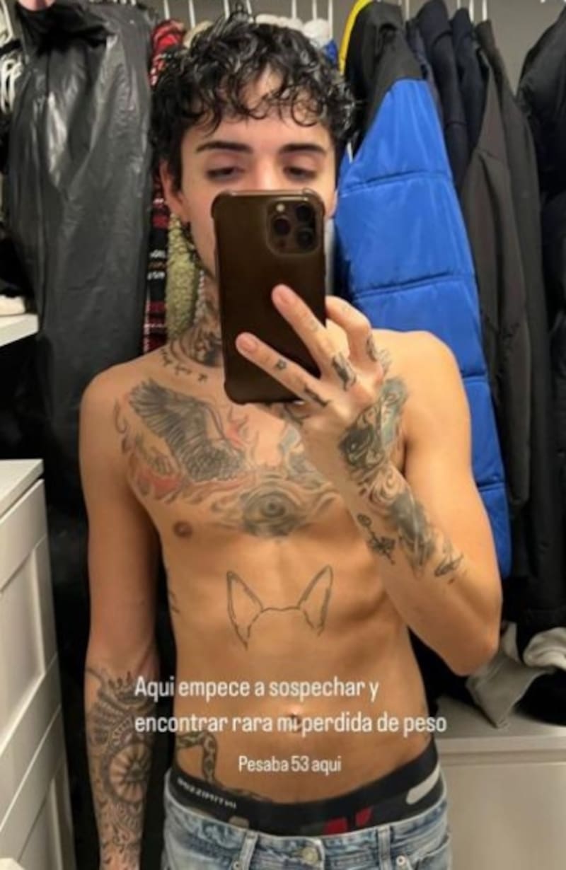 Así lucía antes el joven, según comentó en redes sociales.