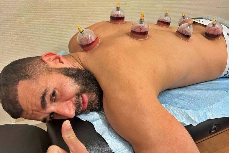Karim Benzema se saca las tensiones con una terapia de ventosas