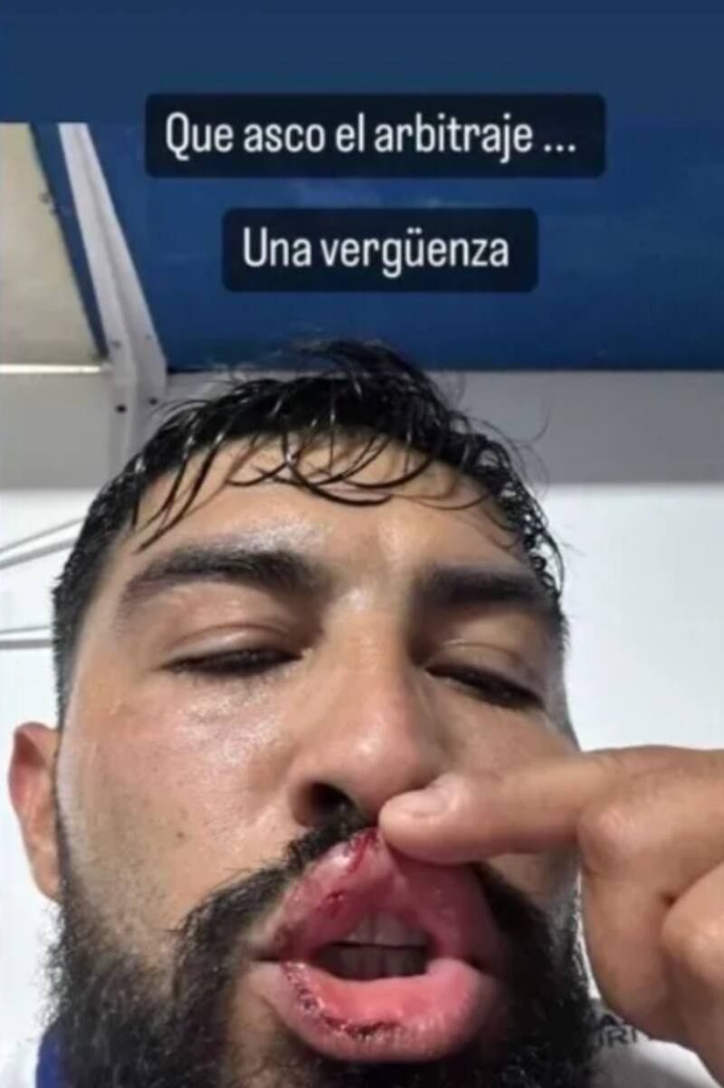 Se quejó por el arbitraje de Cristián Droguett.
