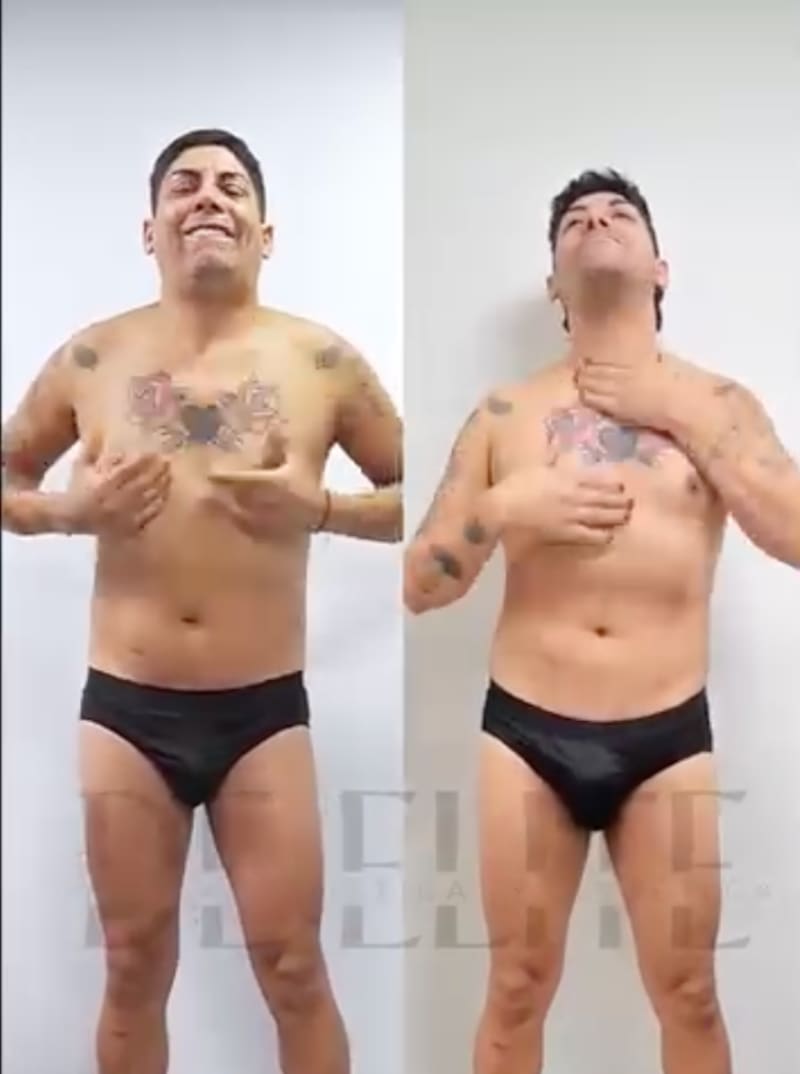 La transformista mostró su antes y después tras operación.